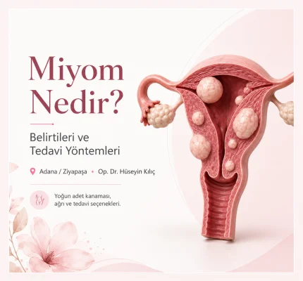Adana Miyom Tedavisi: Miyom Nedir, Belirtileri ve Tedavi Yöntemleri